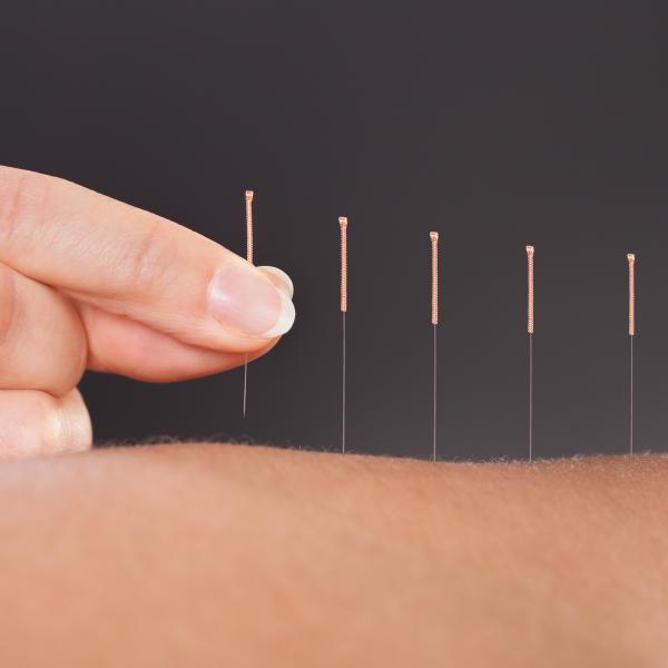 Lessening Knee Replacement Pain Through Dry Needling